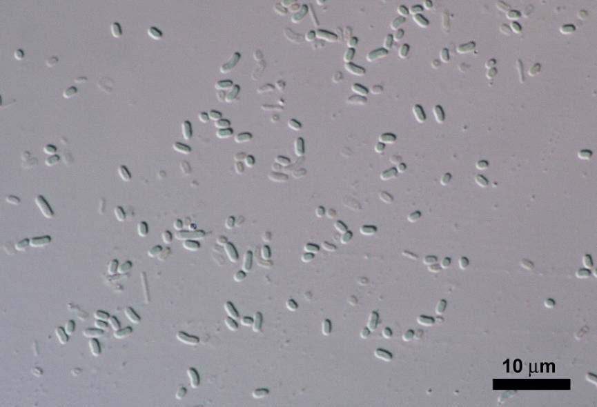Odd.: Cyanophyta/Cyanobacteria Třída: Cyanophyceae Řád: