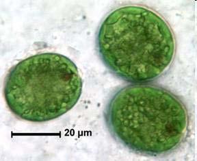 Odd.: Euglenophyta Třída: Euglenophyceae Řád: Euglenales Biotop: stojaté vody