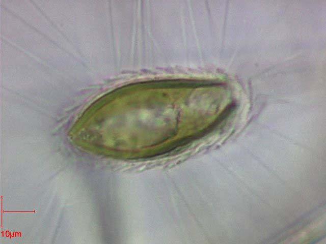 Odd.: Heterokontophyta Třída: Synurophyceae Řád: Synurales osten