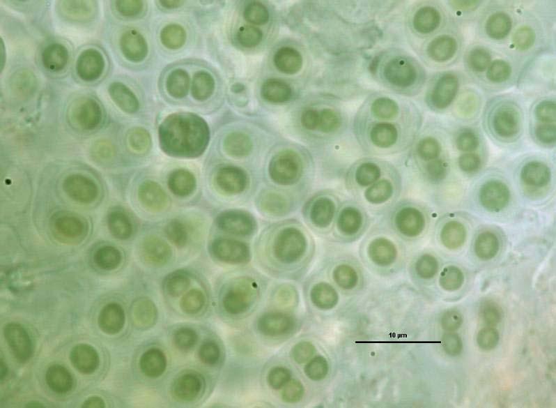 Odd.: Cyanophyta/Cyanobacteria Třída: Cyanophyceae Řád: Chroococcales