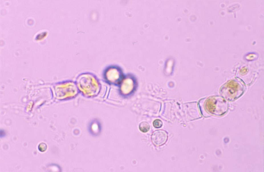 Odd.: Heterokontophyta Třída: Xanthophyceae Řád: Tribonematales Tvorba klidových jednobuňečných