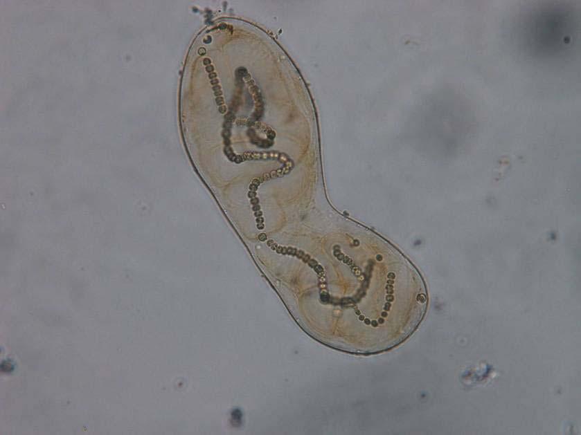 Odd.: Cyanophyta/Cyanobacteria Třída: Cyanophyceae Řád: Nostocales heterocyt