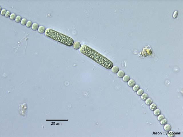 Odd.: Cyanophyta/Cyanobacteria Třída: Cyanophyceae Řád: Nostocales