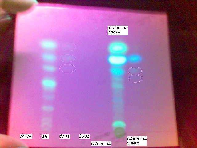 UV 366 nm