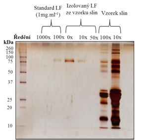 Způsoby uvolňování iontů z kolony: b)eluce přenábojováním (gradientem ph): Ionex (anex) ŠIMAN, Pavel. Chromatografie. Ústav lékařské biochemie, 2013, s. 38.