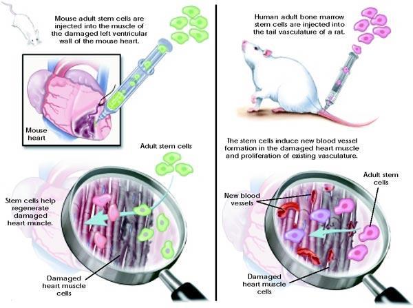 Příloha č. 4: Příklady terapie poškozeného srdečního svalu s použitím adultních kmenových buněk na zvířatech Zdroj: Stem Cell Information. Stem Cell Basics.