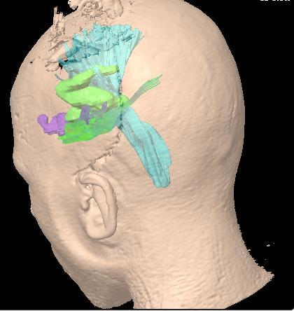 Tensor Imaging Porovnání