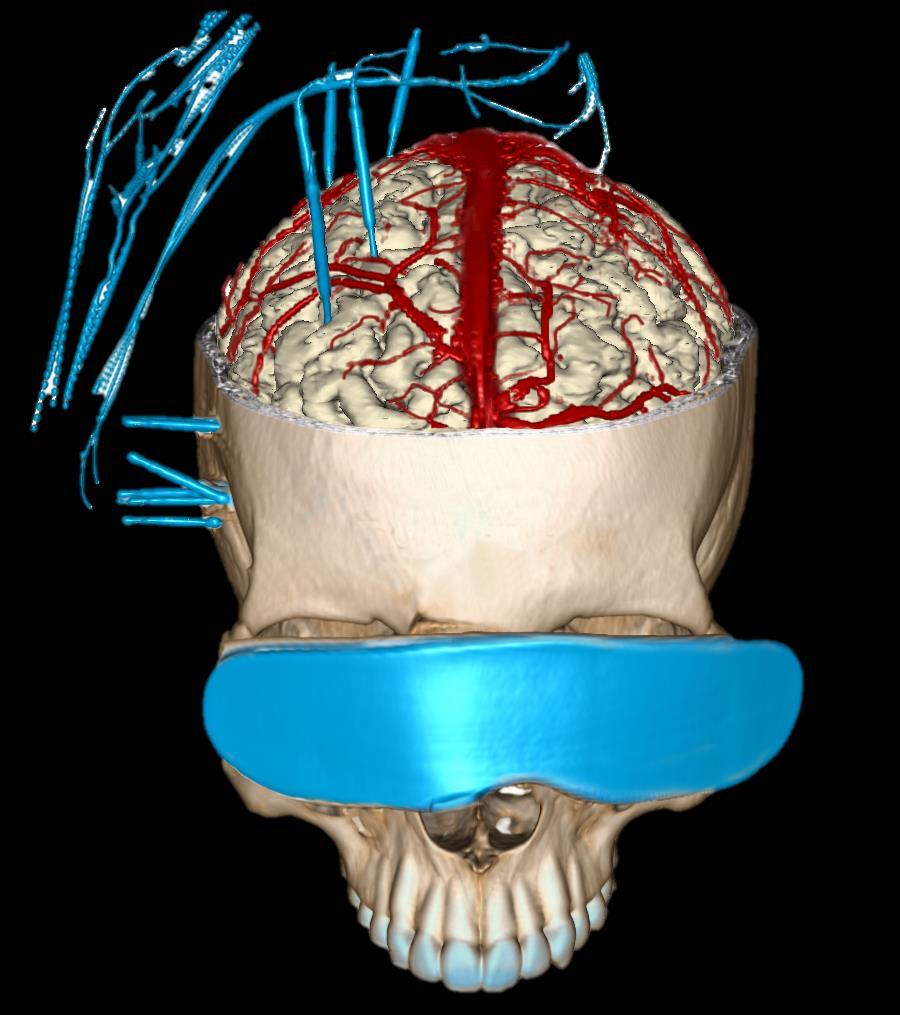 Neurozobrazení MRI+kontrast
