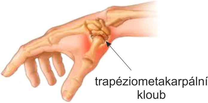 1 ÚVOD S ohledem na zařazení této diplomové práce do oboru nazvaného biomechanika by bylo příhodné tento pojem analyzovat a co nejvýstižněji definovat.