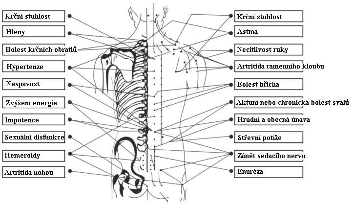 Důležité body lidského těla Na lidském těle je kolem 650 bodů v oblasti od krku po pas. Každý z bodů je připojen na některý z orgánů.