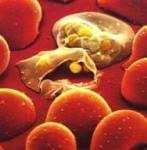 význam: - napadá červené krvinky člověka a způsobuje onemocnění MALÁRIE Mapa výskytu malárie z roku 2000 Malárie ročně sužuje kolem 300 a 500 milionů lidí, přičemž zhruba 1% nemocných zemře.
