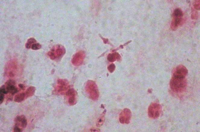 Bacteroides sp. www.medmicro.info, foto O. Z.
