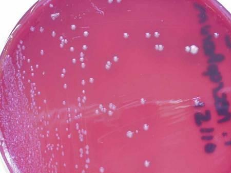 Fusobacterium sp.