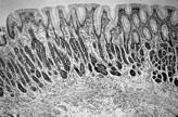 Nature Reviews Molecular Cell Biology 2001; 2: 457-466 NORMÁLNÍ SLIZNICE p - IARC 1994 kancerogen 1.třídy KAZUISTIKA: 12-01-2005 Muž - J.N. - IT specialista -