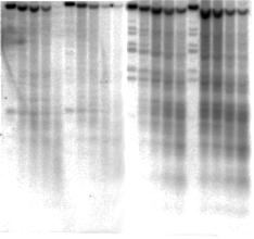 Indirect end labeling autoradiogram Klon Deprot.