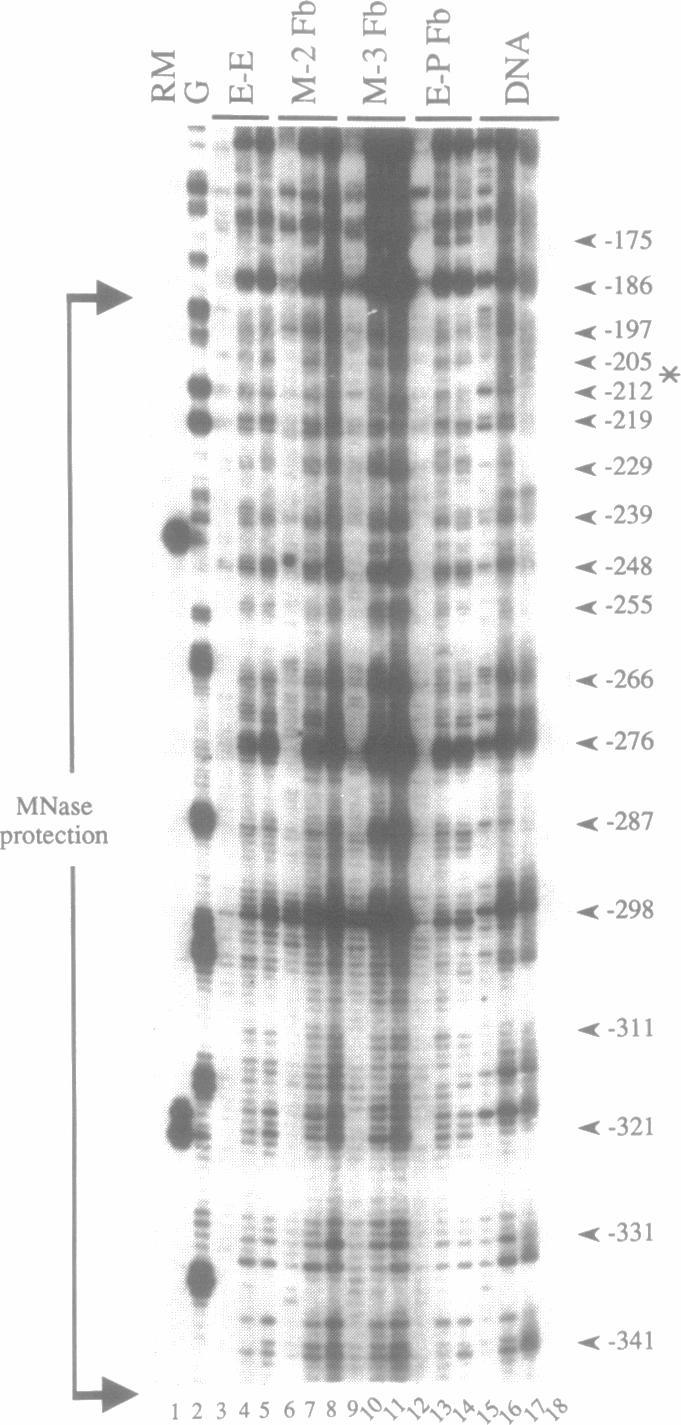 Štěpení chromatinu in vivo DNázou I genomic footprinting autoradiogram J. R.