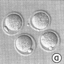 Oocyt ~0,12 mm Jedna z největších a nejvzácnějších (počtem i významem) buněk v těle.