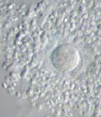 Oplození (4) Cesta spermií do místa oplození 2 7 hodin Vagina 200-600 milionů spermií Děložní krček Děloha Vejcovod 100-1000 spermií Kyselé prostředí Aktivní pohyb