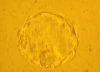 1998) Časné embryo ve stadiu