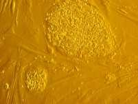 embryoblastu do in vitro