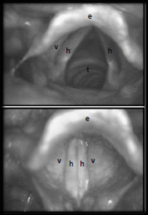 2.4. Struktura hrtanu Hlasivky jsou součástí hrtanu. Využitím laryngoskopie se nám naskytne pohled shora na hrtan viz obr.2.9.
