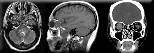 pozitronová emisní tomografie nebo pozitronová emisní tomografie/výpočetní tomografie (PET/CT), diagnostická endoskopie [10