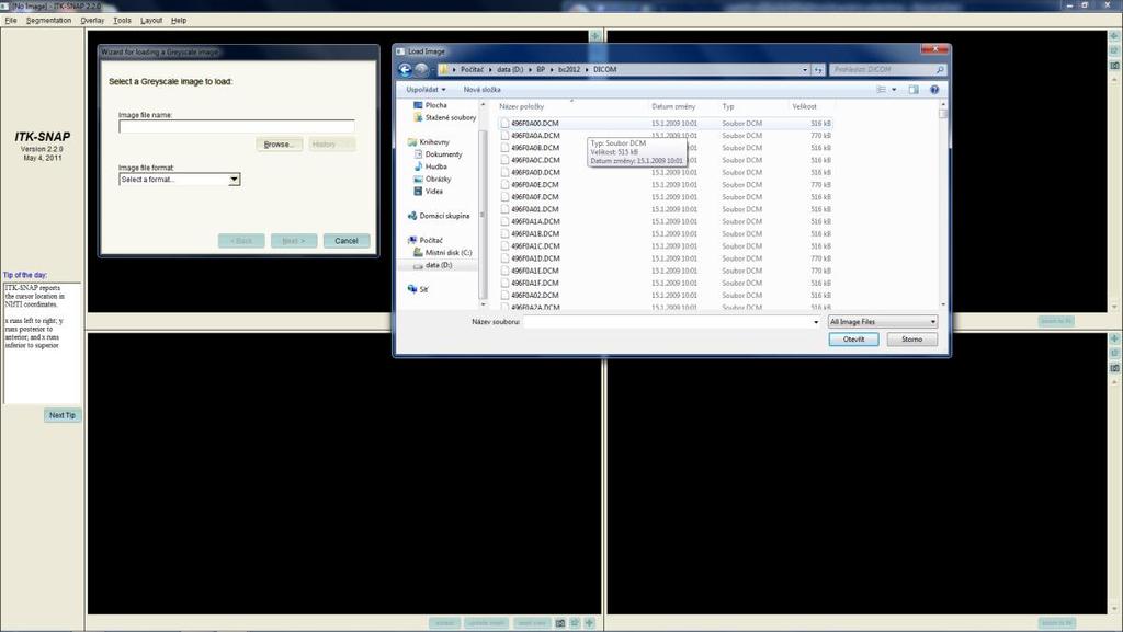 Načtení CT snímků do ITK SNAPU Obr. 4.3. Postup načtení CT snímků do programu ITK SNAP Pro načtení snímků využijeme Open Grayscale Image (ctrl+g), které najdeme pod tlačítkem File.