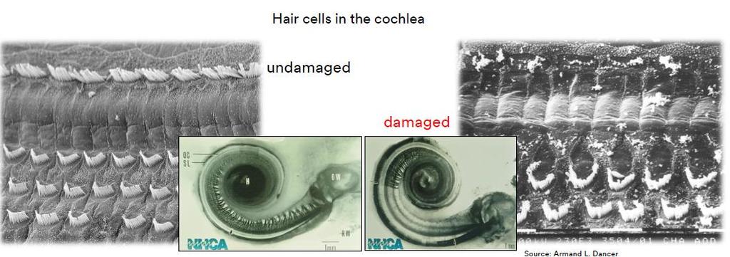 Poškození sluchu Vlasové buňky v