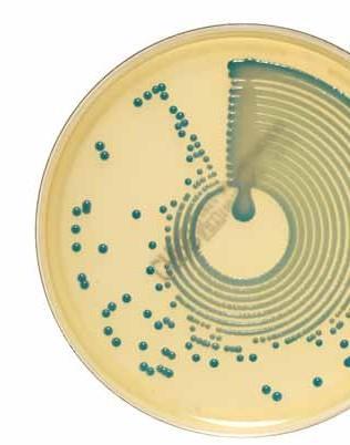 ATB CITLIVOSTI MOLEKULÁRNÍ BIOLOGIE SÉROLOGIE CHROMOGENNÍ KULTIVAČNÍ ME DIA CHROMID DEHYDRATOVANÁ MÉDIA PŮDY V PETRIHO MISKÁCH SELEKTIVNÍ PŮDY V PETRIHO MISKÁCH Chromogenní kultivační média