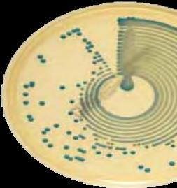 difficile a Clostridium difficile-agar CHROMID CARBA CHROMID OXA-48 CHROMID CARBA SMART CHROMID MRSA CHROMID MRSA/CHROMID S.