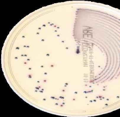 SELEKTIVNÍ PŮDY V PETRIHO MISKÁCH Chromogenní kultivační média Screening multirezistentních organismů (MDRO) (CHROMID VRE) DEHYDRATOVANÁ MÉDIA PŮDY V PETRIHO MISKÁCH SELEKTIVNÍ PŮDY V PETRIHO MISKÁCH