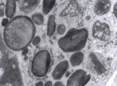 V cytoplazmě nacházíme několik (nejméně pět rozdílných typů granul): (26) 1.