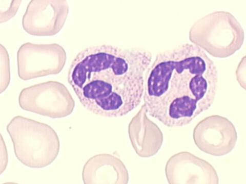 Při úmrtí neutrofilu nebo vylití obsahu cytoplazmatického granula do extracelulárního prostoru, se můţe obsah cytoplazmatických granul uvolnit mimo buňku.