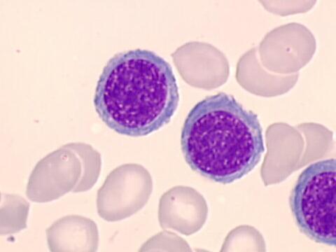 Bazofily jsou cirkulující granulocyty s mnohými funkčními vlastnostmi tkáňových ţírných buněk, v tkáních se však běţně nevyskytují. Jejich cytoplazmatická granula obsahují histamin.