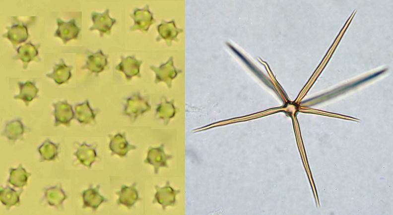 Russulales Asterostroma medium hvězdnatka