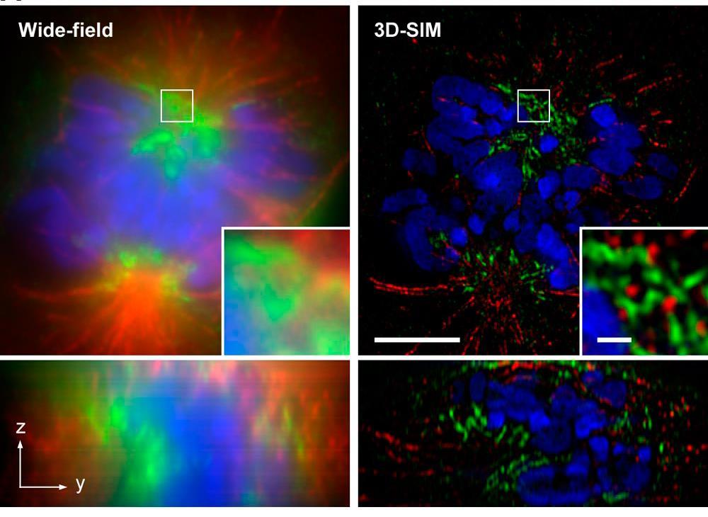 Conventional wide-field image (left) and 3D-SIM image of a mouse C2C12 prometaphase cell stained with primary antibodies against lamin B and tubulin, and secondary antibodies conjugated to Alexa 488