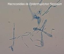 Microsporum canis, M.