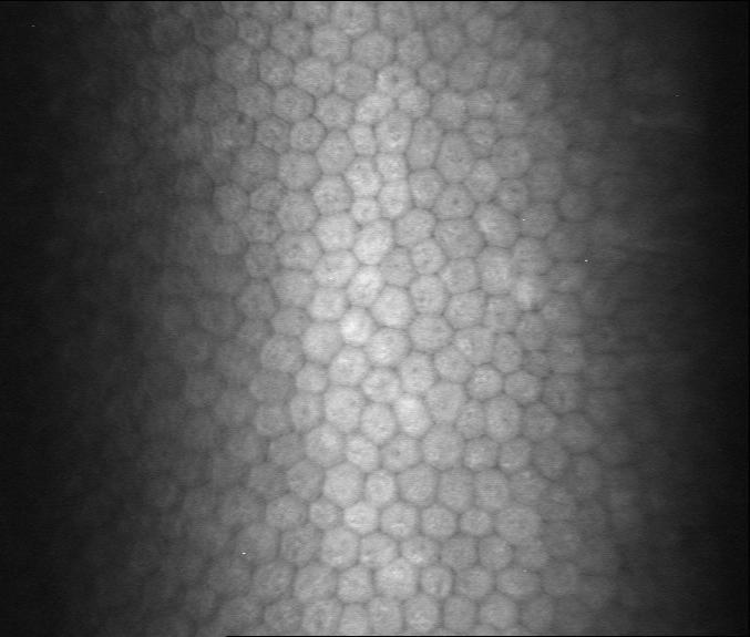 Konfokální mikroskopie je moderní neinvazivní vyšetřovací metoda umoţňující znázornit jednotlivé vrstvy rohovky v optických řezech s vysokou rozlišovací schopností, která je dána detekcí světla pouze
