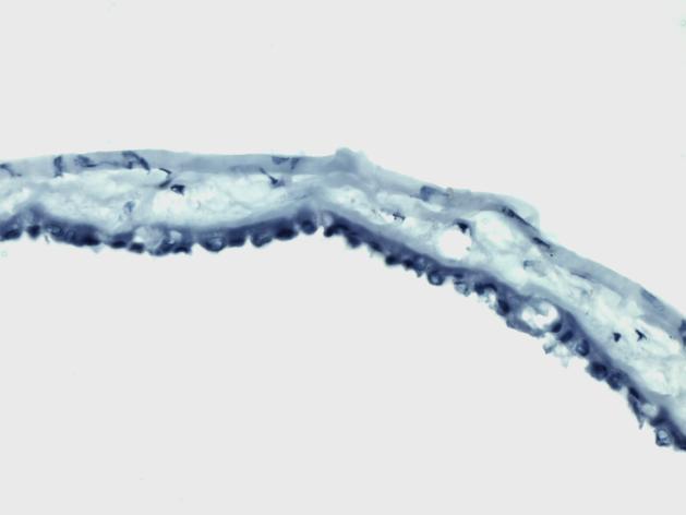 1 Stavba amniové membrány Amniová membrána je průsvitná tkáň sloţená z epitelu, silné bazální membrány a vrstvy stromatu (Obr. 13-A).
