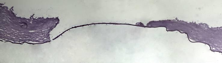 30: Detail histologického řezu zadní rohovkovou lamelou, barvení hematoxylin-eozinem; (A) rohovkové stroma prostoupeno vzduchovými bublinami, jejichž velikost se