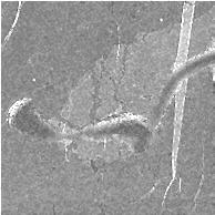 80 kv Obrázek č. 31: Série radiogramů ledvinné tkáně při napětí 40,60,80 kv pro Cu, Mo, W materiál anody.