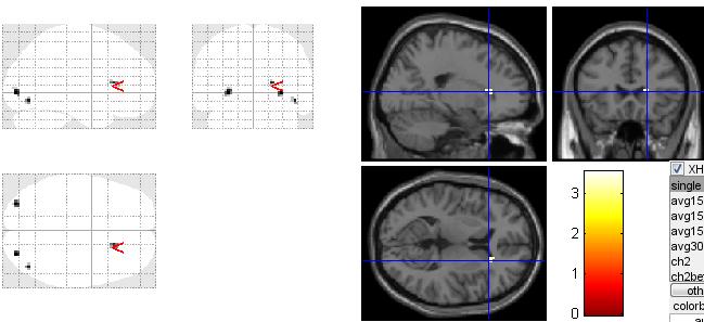 GLM model Základními parametry pro GLM model jsou jednotlivé funkční skeny fmri, regresor, délka TR a další pomocné proměnné, které definují chování výsledného modelu.