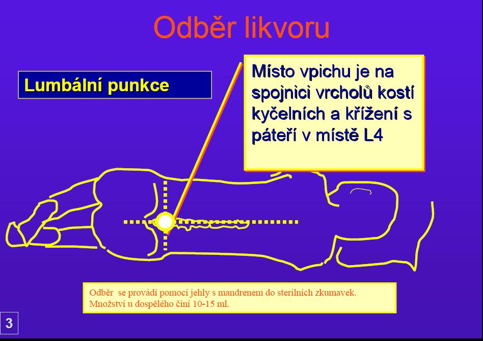 Odběr likvoruvyšetření LIKVORU KATEŘINA MRÁZOVÁVYŠETŘENÍ VYŠETŘENÍ LIKVORU MRÁZOVÁKATEŘINA MRÁZOVÁ33Místo Místo vpichu je na spojnici vrcholů kostí kyčelních a křížení s páteří v místě L4Místo vpichu