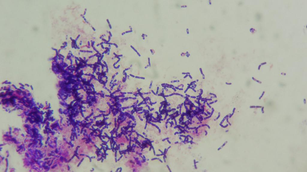 r. Bacillus G+