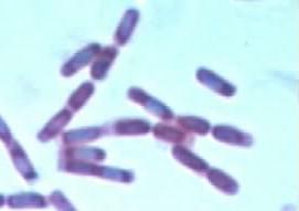 Bacillus cereus