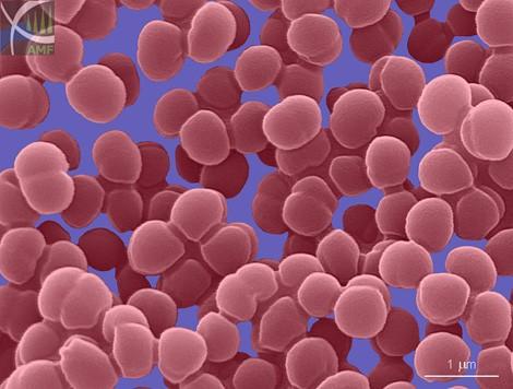 http://www.biology.ualberta.ca/facilities/microscopy/uploads/gallery/esem/10b-staphylococcus-sp_mediu.jpg Rozbor případu Chorobu způsobil kmen zlatého stafylokoka Staphylococcus aureus.