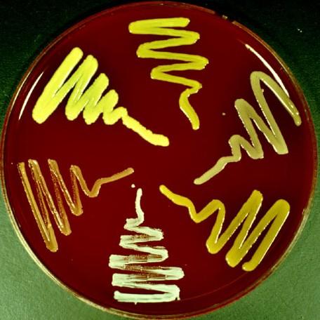 Mikrokoky mají krásné pigmenty Micrococcus luteus je sírově žlutý (ne