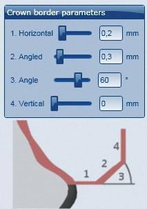 POUŽITÍ Okrajové parametry v CAD softwaru U Ceramill Zolid Preshades by se mělo dbát na to, aby byly tloušťky okraje dostatečné. Doporučené hodnoty jsou: _1. Tloušťka okraje (Horizontal): 0,2 mm _2.