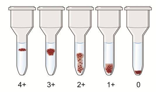 Zkumavkový test je v klinické laboratoři stále využíván při zjišťování krevních skupin AB0 a antigenů za pomoci protilátky třídy IgM (z ekonomických, ale i časových důvodů).