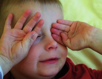 K subjektivním příznakům patří projevy orálního alergického syndromu, dále pruritus lokalizovaný nebo generalizovaný, nosní nebo oční pálení a svědění, pocit stažení hrdla, dyspnoe bez objektivních